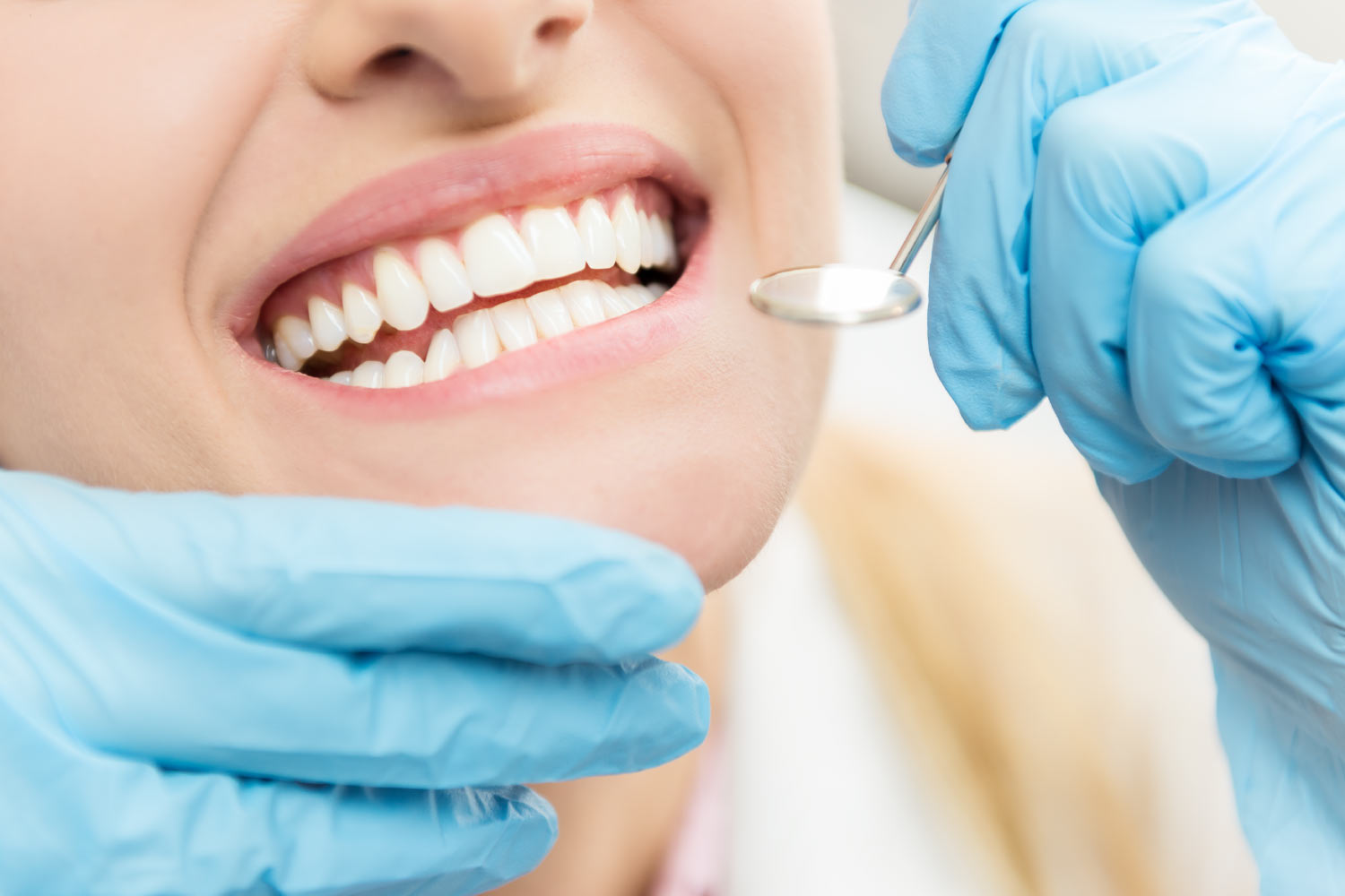 Closeup of a woman's mouth after receiving a dental cleaning at the dentist in Cedar Park, TX