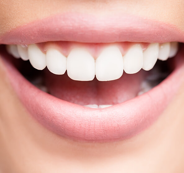 closeup of a bright, white smile