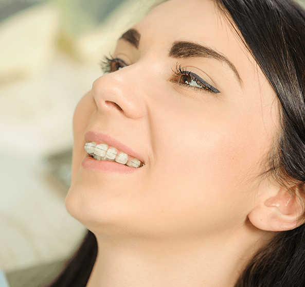 girl with ceramic braces