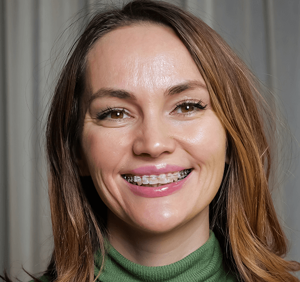 woman with ceramic braces