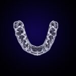 Invisalign retainers, invisalign retainer mistakes