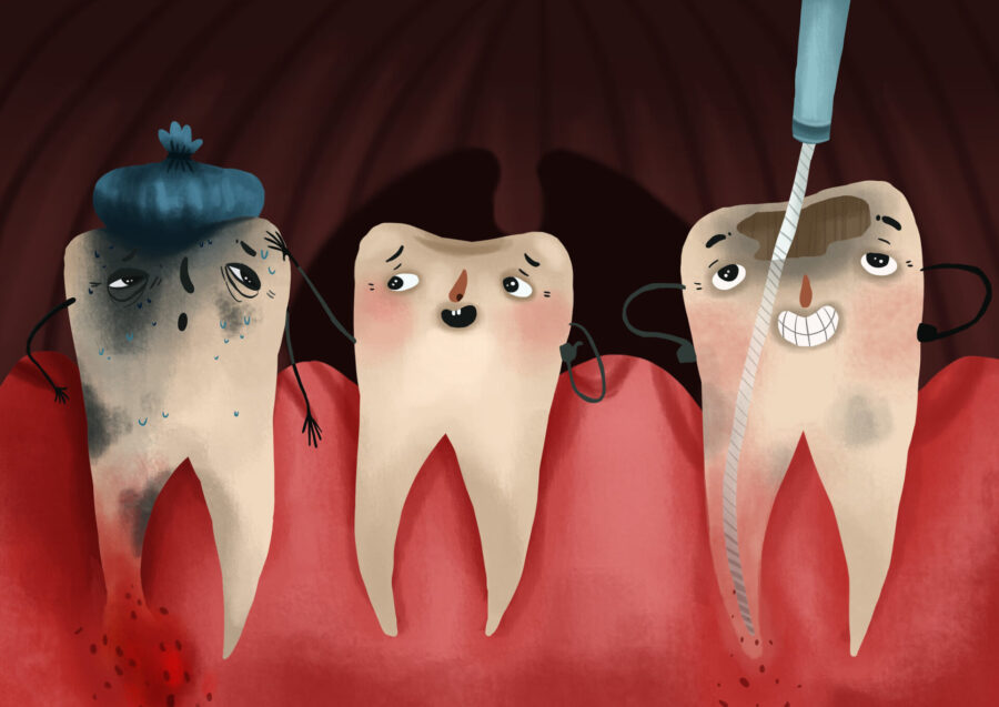 tooth getting root canal therapy vs dental implant